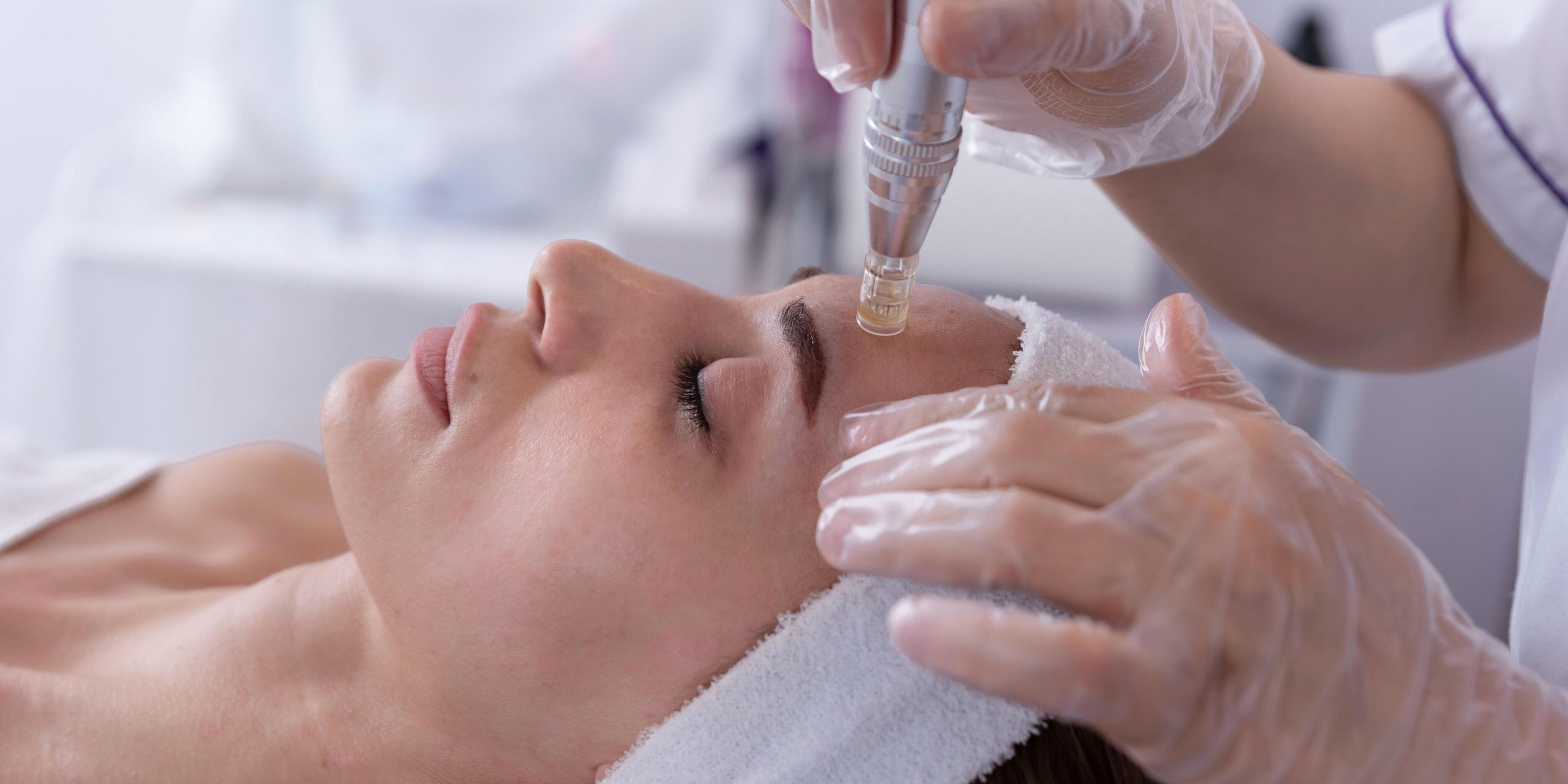 Micro-Needling